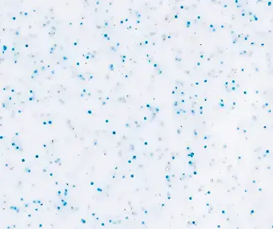 White surface with a scattered pattern of small blue specks.